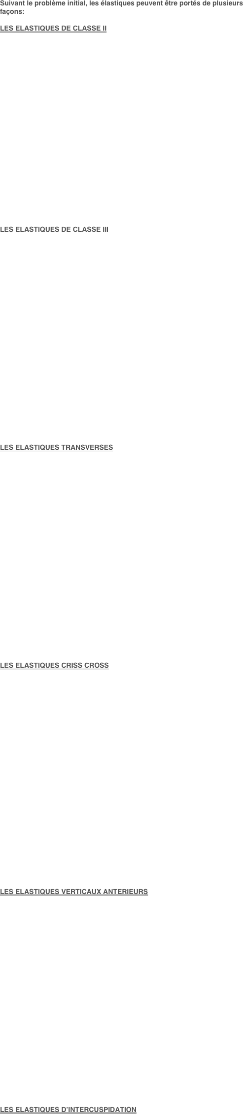Suivant le problème initial, les élastiques peuvent être portés de plusieurs façons:

LES ELASTIQUES DE CLASSE II























LES ELASTIQUES DE CLASSE III

























LES ELASTIQUES TRANSVERSES

























LES ELASTIQUES CRISS CROSS


























LES ELASTIQUES VERTICAUX ANTERIEURS

























LES ELASTIQUES D’INTERCUSPIDATION




